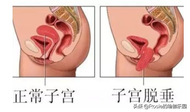 盘坐后腿疼,盘膝坐后直立起来腿痛