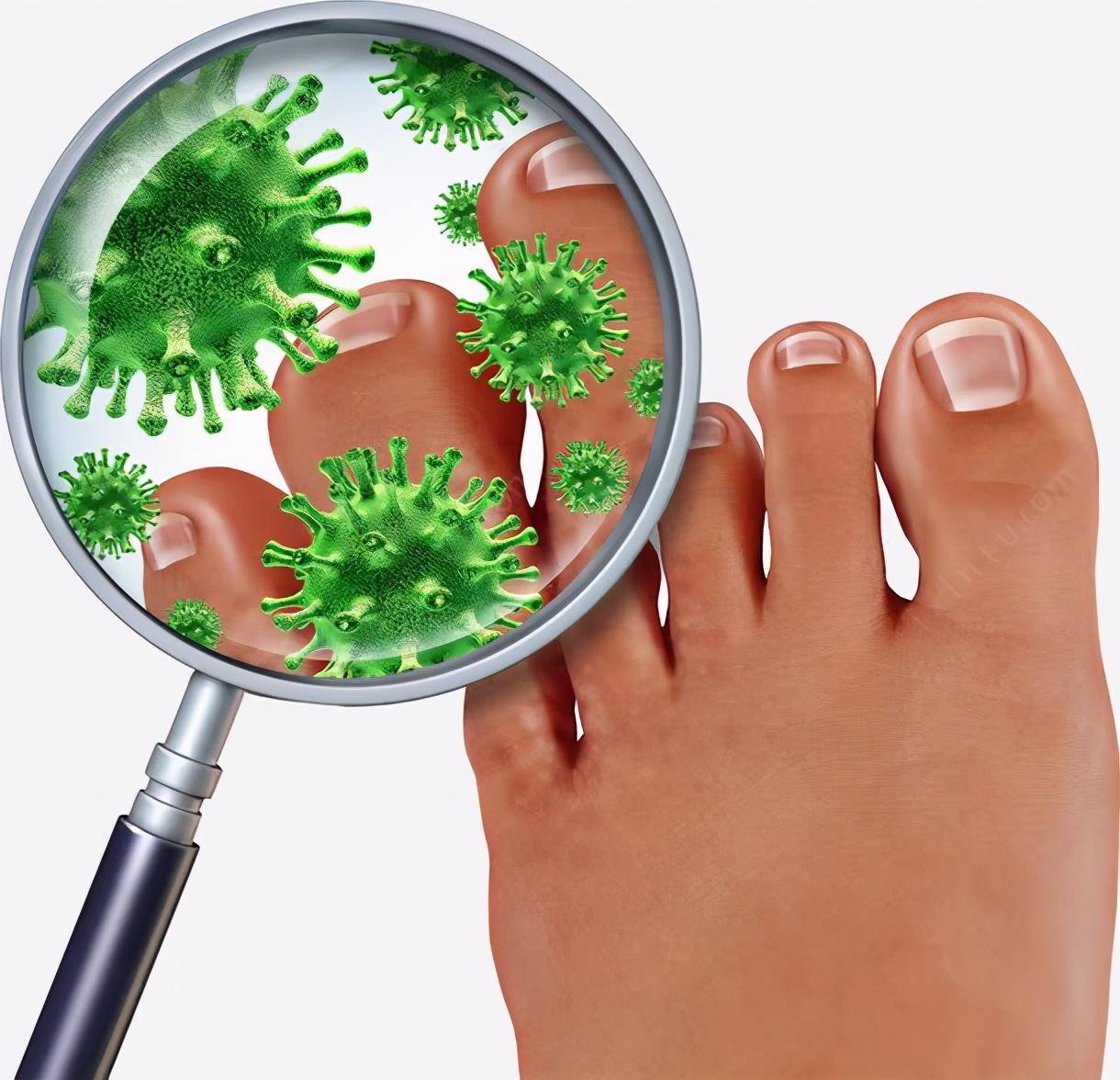 脚气发作难忍,脚气奇痒是什么原因