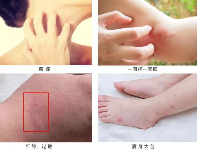 比蚊香更好的驱蚊方式,比蚊香还管用的方法