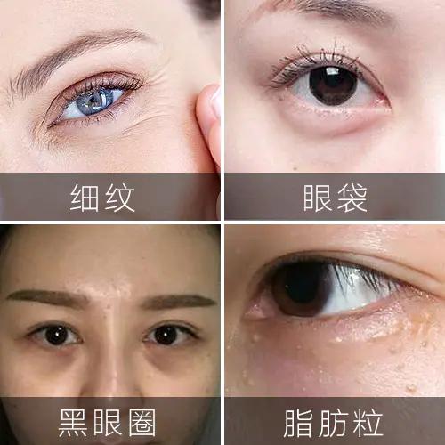 能放进包包的“美容院”，随时淡纹护眼，素颜美女少不了它