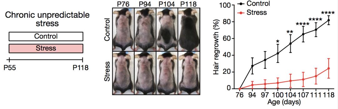 压力大掉头发是怎么回事,压力大掉头发咋办