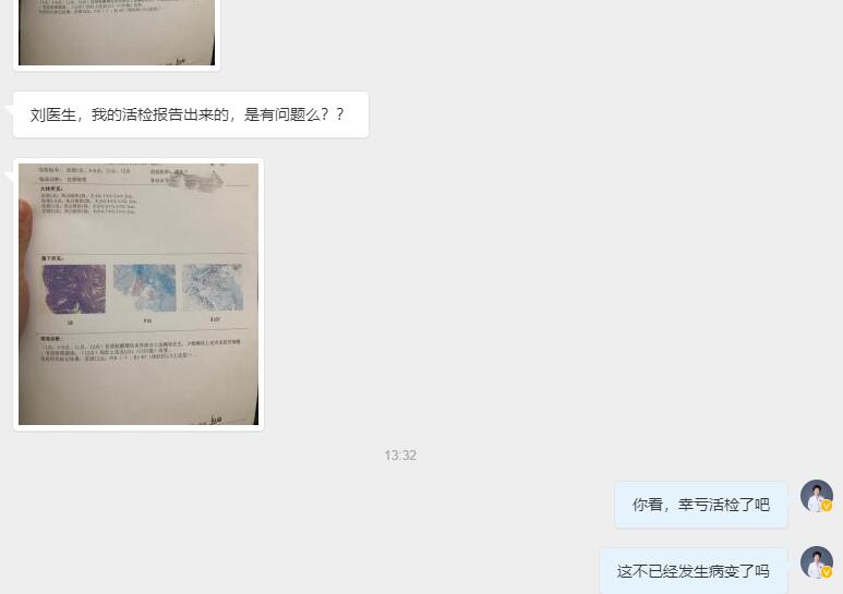 没任何症状还用查hpv吗,宫颈癌除了活检还能怎么确定