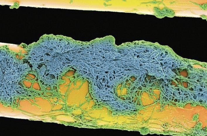 放大两千倍的牙齿表面长什么样？不愧是人体最脏的地方，不堪入目