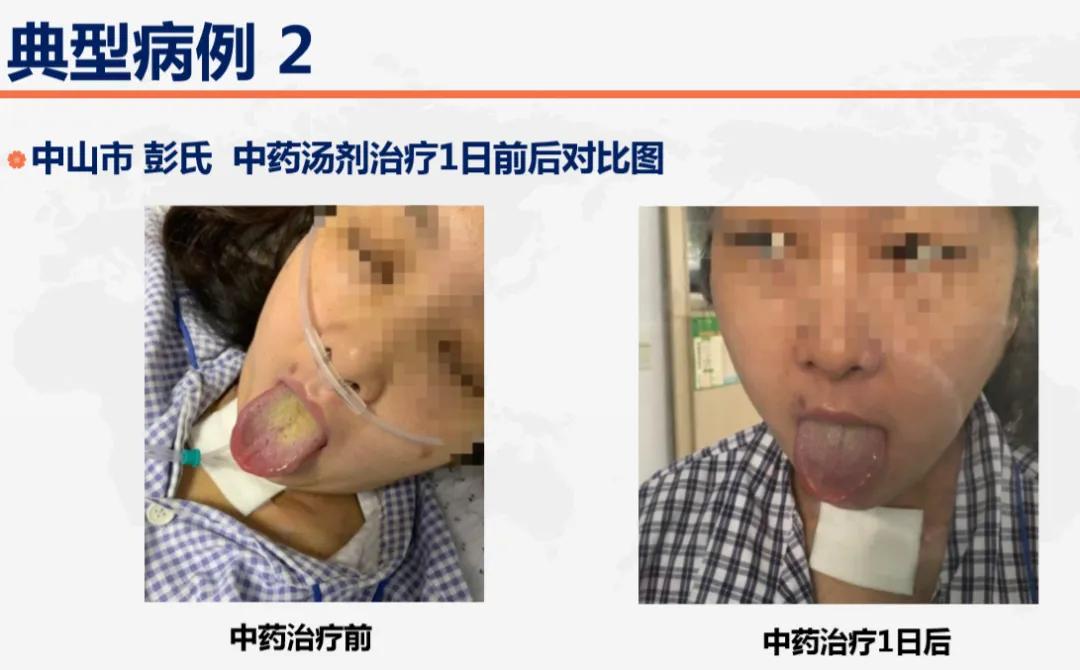 总有效率超90%！美国纽约多家中药房中药材已脱销！中医药出海全球抗疫却困难重重，阻力在哪？