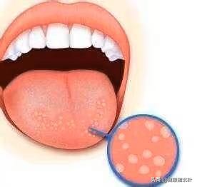 一招教你看舌苔6种舌苔你是哪种,身体好不好看嘴唇就知道了