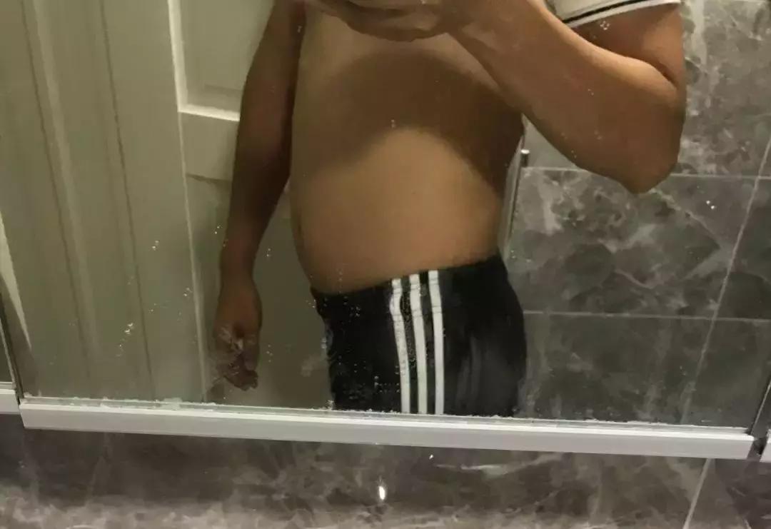 肚子突出屁股后翘正常吗,肚子大腰弯屁股翘怎么矫正