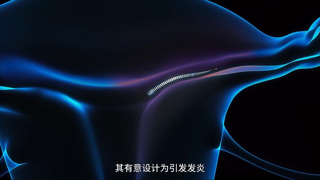 尖端医疗纪录片全集,纪录片高端医疗的真相