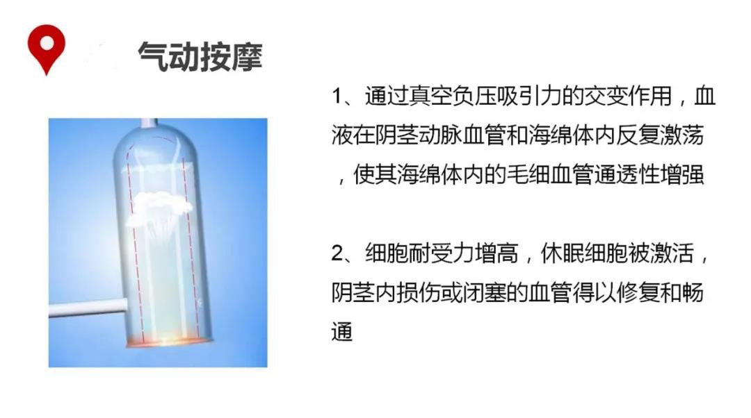 「勃起功能障碍」可以做这种康复治疗,再不了解就晚了