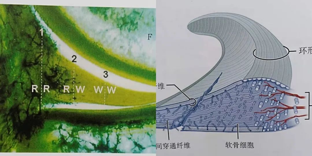 半月板损伤到底是怎么一回事,半月板后角损伤二级算严重吗