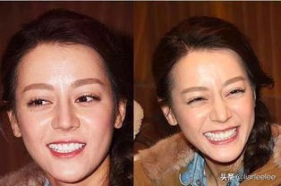 防眼角皱纹最好的方法,眼部皱纹多特别显老