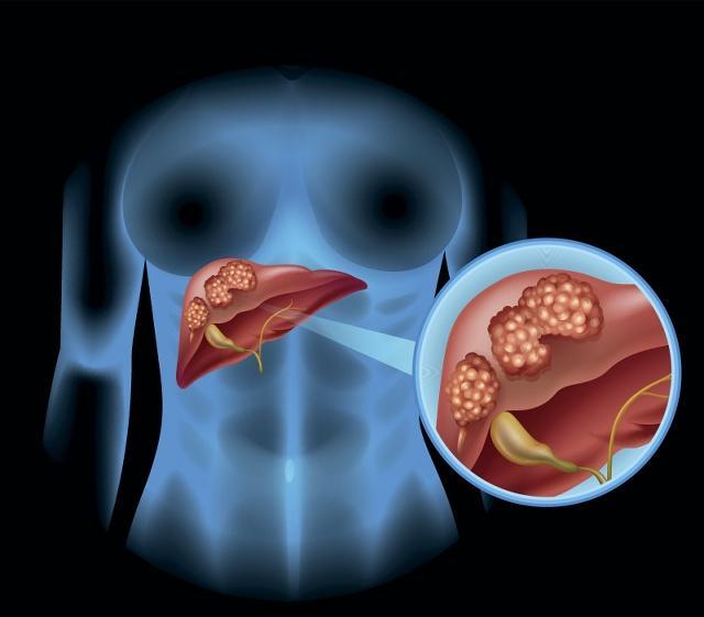 乙肝治不好还有治疗的必要吗,乙肝1245可以打干扰素可以治愈么
