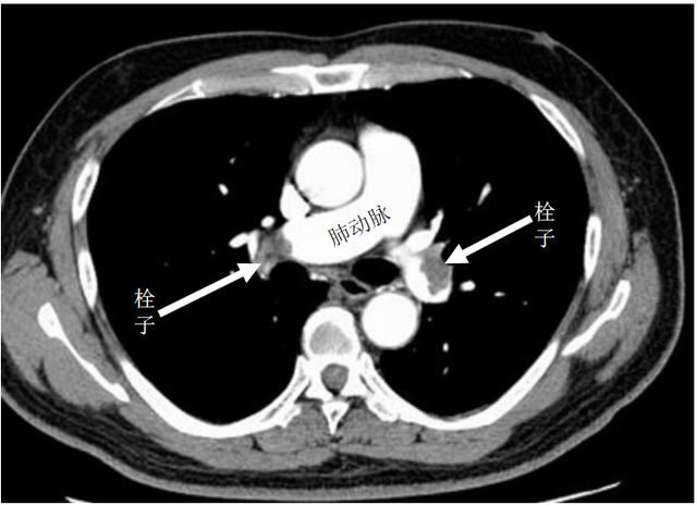 下肢肿胀怎样办,下肢经常肿胀怎么检查