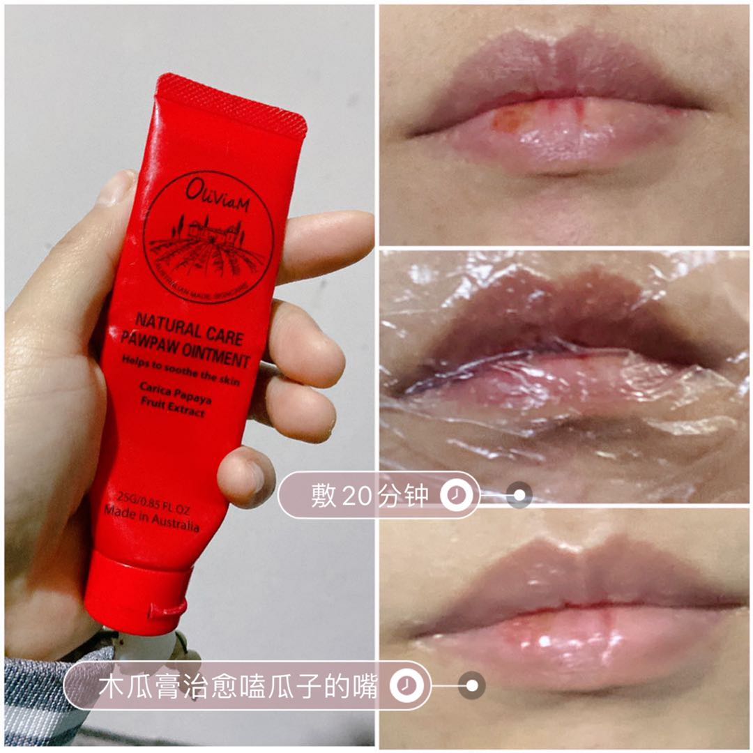 澳洲木瓜膏可以祛痘消炎吗,木瓜膏祛痘疤