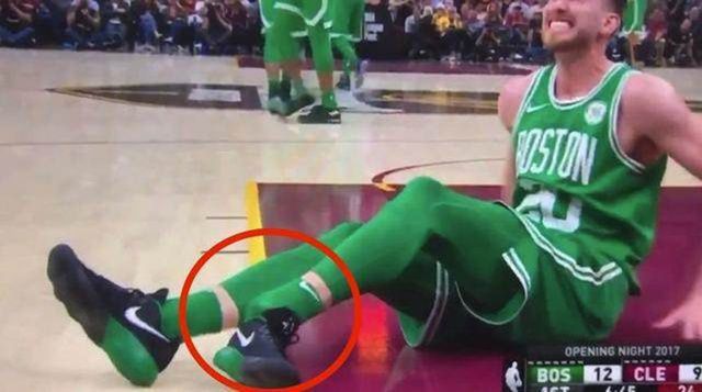 很羡慕NBA打球?你不知道他们烦恼!詹皇脚趾变形,有人甚至断腿