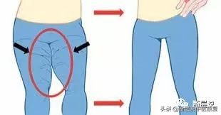 女性盆底健康问题，针刺要扎三阴交，手法要选内收肌