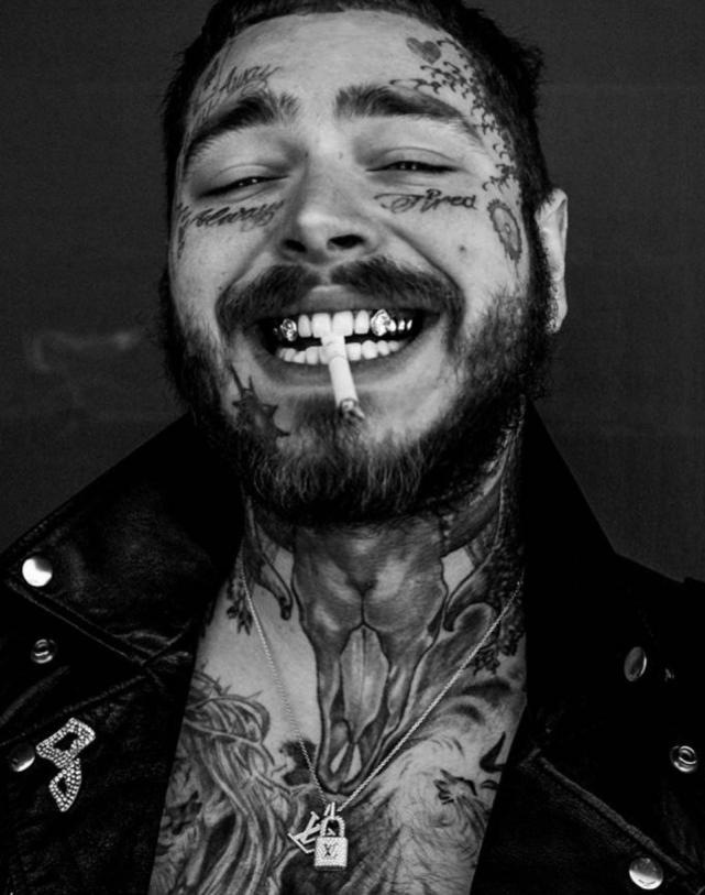 人体改造！美*歌国**手镶1千万钻石牙，还有人额头镶1.5亿粉钻成幻视