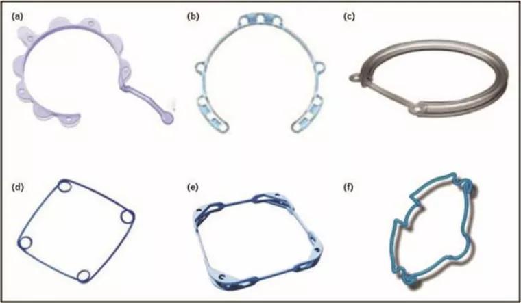 小瞳孔白内障的治疗,瞳孔小能做白内障手术吗