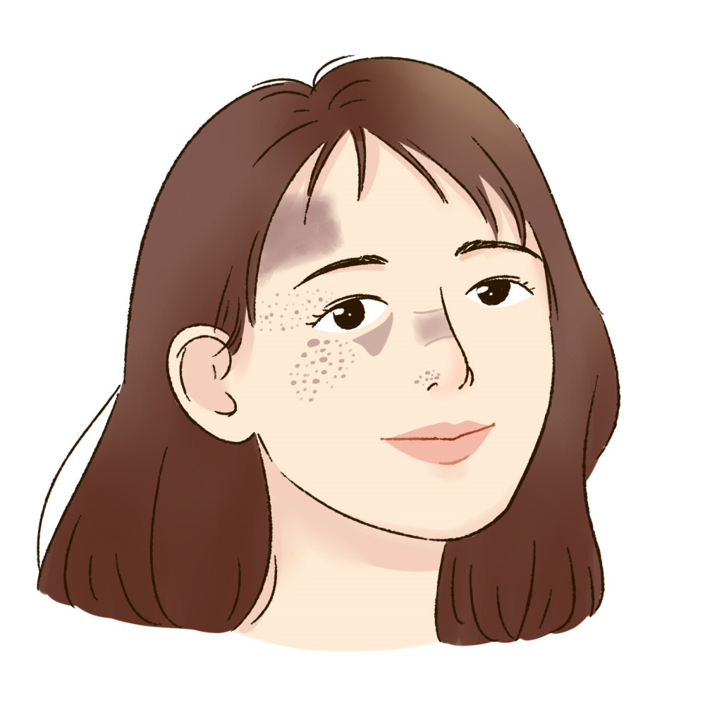 教我们如何淡斑祛斑,如何自己祛斑淡斑