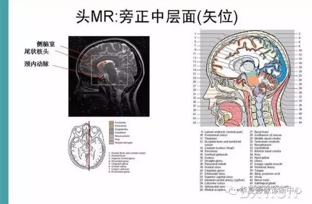 mra头颅解剖学详细讲解视频,常见的头颅mri图像