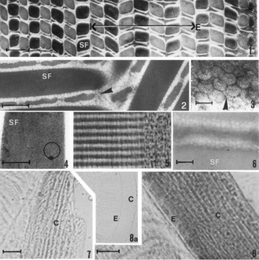 铁线虫为何多感染螳螂,螳螂寄生铁线虫概率视频