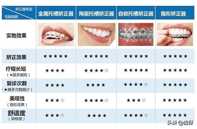 烤瓷牙结实吗,陶瓷自锁牙比较贵吗