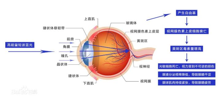 怎么挑选适合自己的眼镜框,怎么挑选自己合适的眼镜框