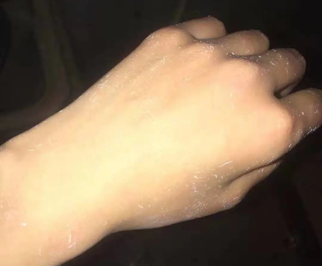 护肤品搓泥怎么救,护肤品搓泥怎么办