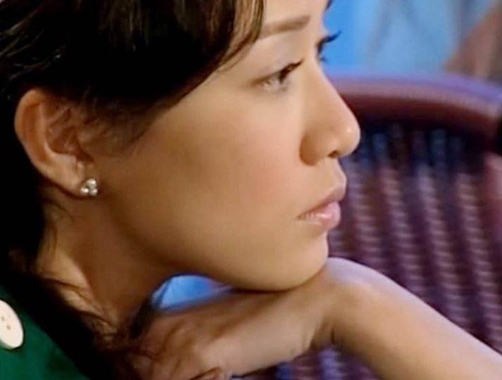 鼻头大鼻翼宽怎么改鼻痕,整鼻不好看怎么办