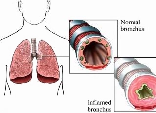 杭州梅雨季节怎么办,杭州梅雨季节防潮怎么处理