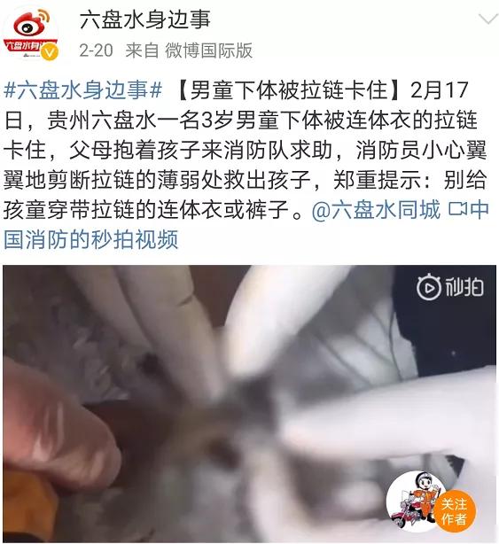 男孩儿被拉链卡住了,男孩被拉链卡住了眼皮被扯掉