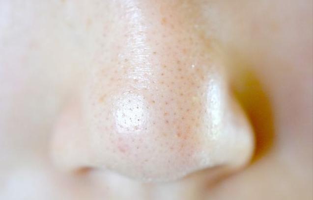 毛孔粗大推荐产品,最好用的收缩毛孔的产品