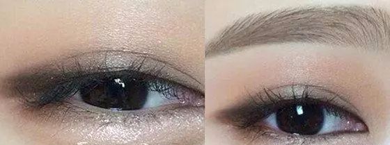 眼睛小怎么办最有效的方法,眼睛小是因为什么原因要怎么解决