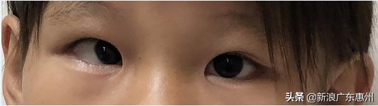 爱尔眼科公益救助活动方案,公益救助贫困儿童