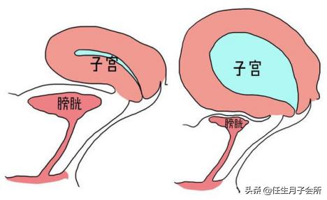 怀孕一个月小产后七大禁忌是什么,医生提醒孕妈产后要知道的11件事