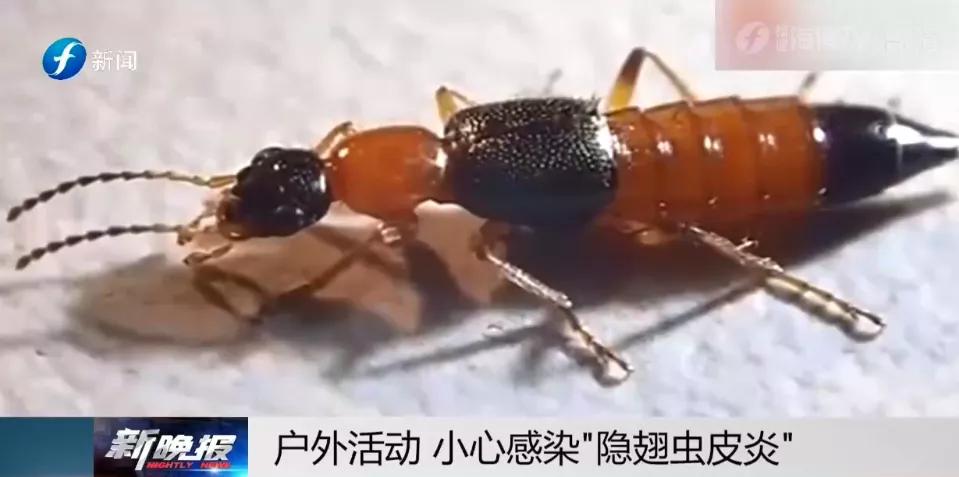 户外远离虫子的方法,哪些虫子在户外小朋友是不能碰的