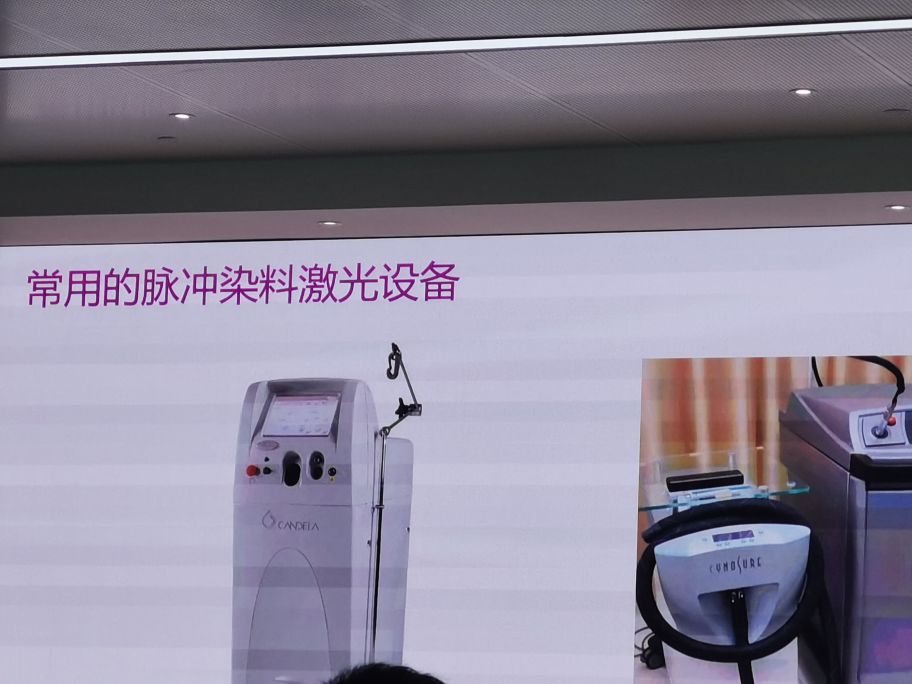 脉冲染料激光治玫瑰痤疮怎么收费,脉冲染料激光治疗瘢痕疙瘩