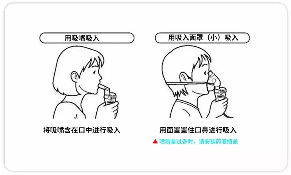 听说雾化治疗危害大?是真是假,看完你就懂