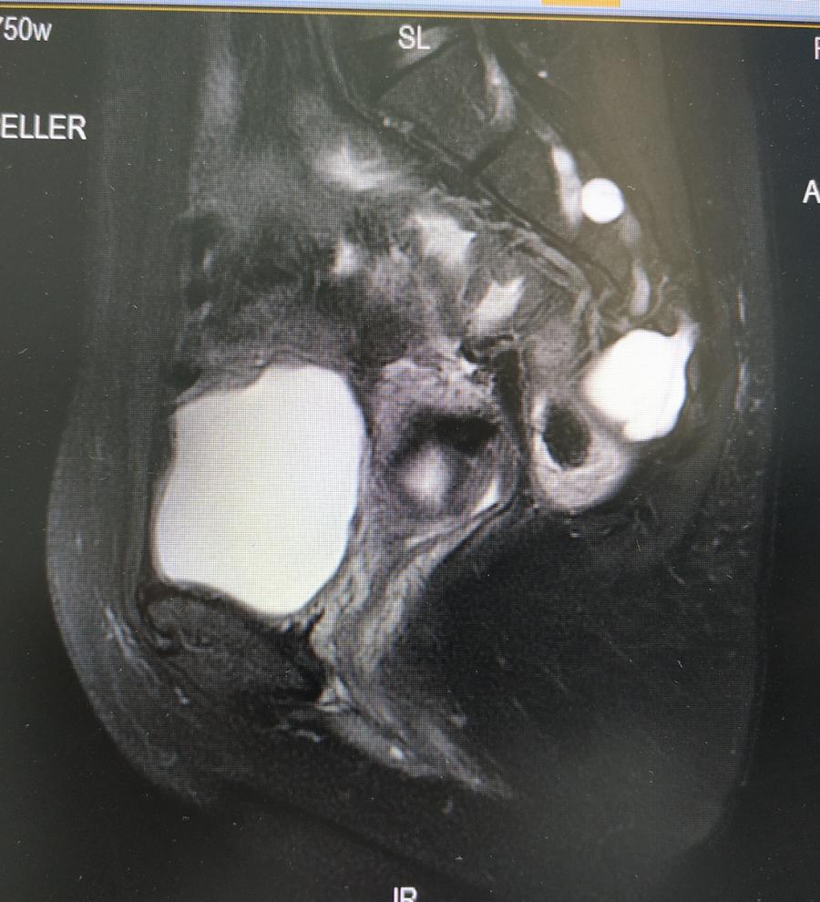 病例分享小结,病例分享及讨论
