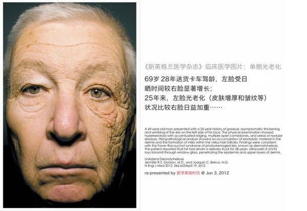 老外防晒霜测评真人暴晒视频,外国人做的防晒测评