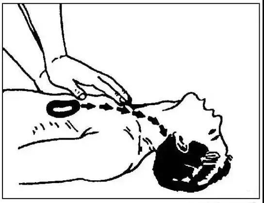 10千伏触电急救方法,电力人员正确触电抢救法