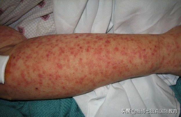 满满干货！这个抗病毒药在流感季节开的特别多，家里有的话快扔吧