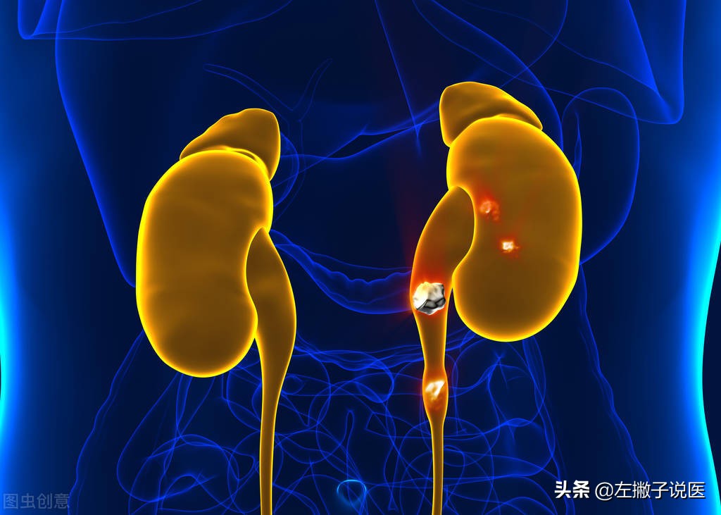 喝水多排尿少是肾出问题了吗,长期喝水少对肾脏的影响