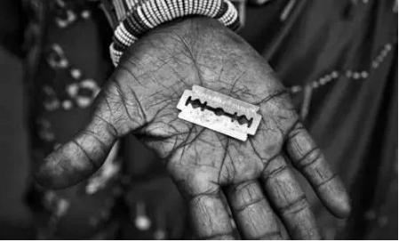 熨平少女胸部!揭秘非洲可怕习俗“烫乳”