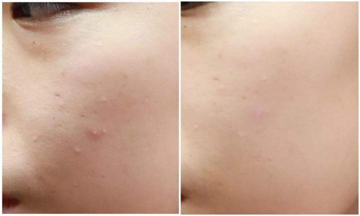 神仙水用时间久了就没效果,神仙水可以延缓皮肤衰老吗