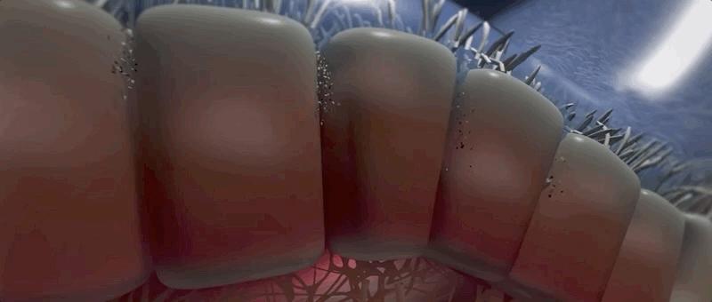 哮喘的发病原理,哮喘科普文章作品简介