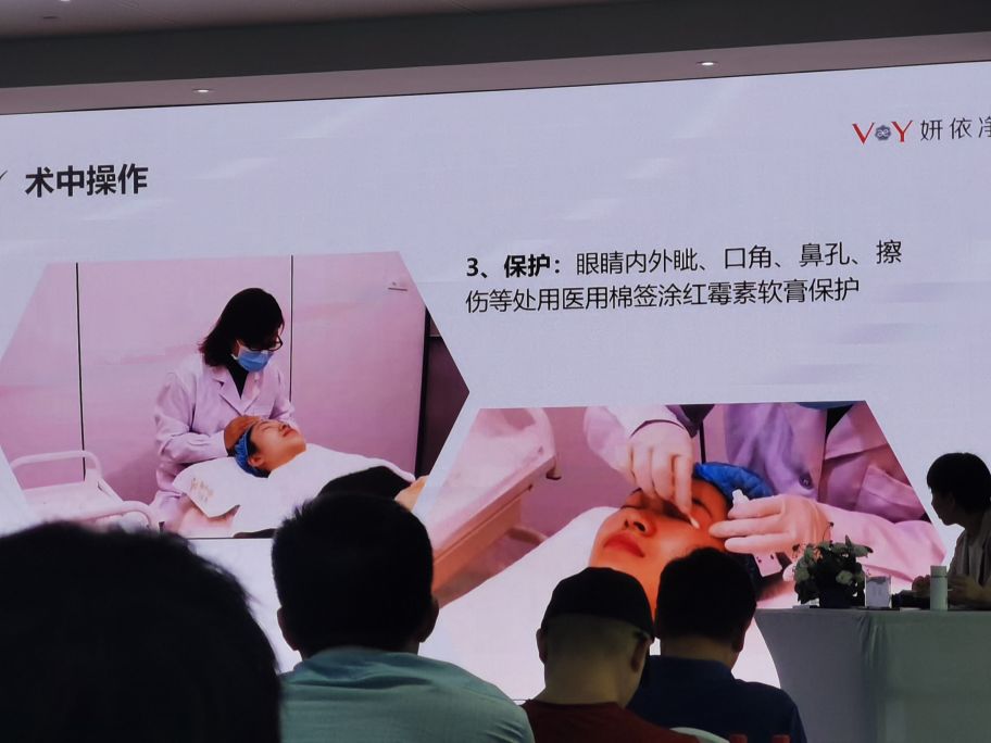 果酸脸部换肤,果酸化学换肤