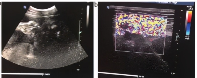PhilipsiU22超声系统图像异常故障维修,仁成医疗