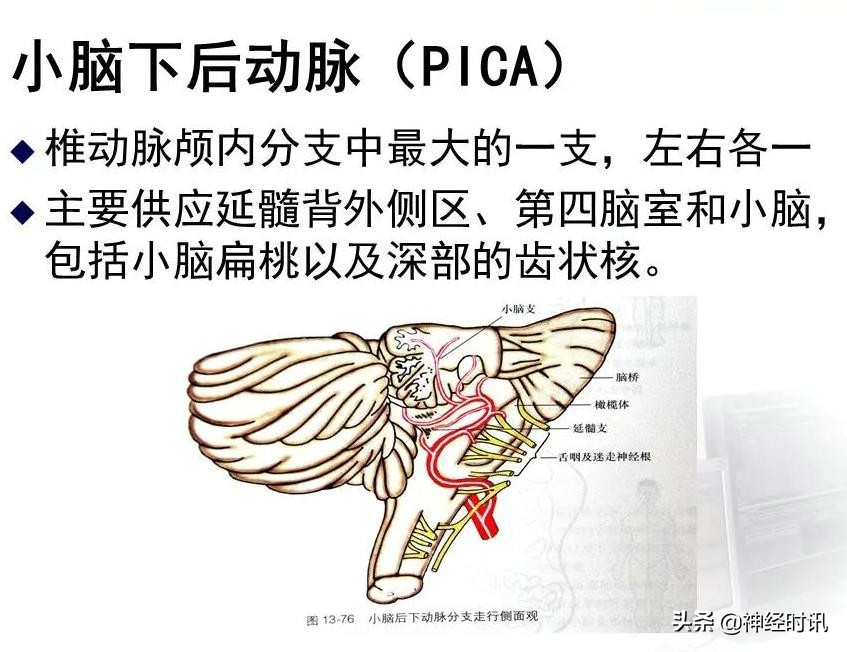 脑动脉解剖学讲解,基底节区脑血管解剖