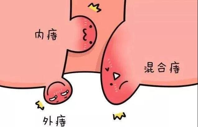 肛门潮湿是怎么回事男性用什么药,肛门瘙痒是什么原因