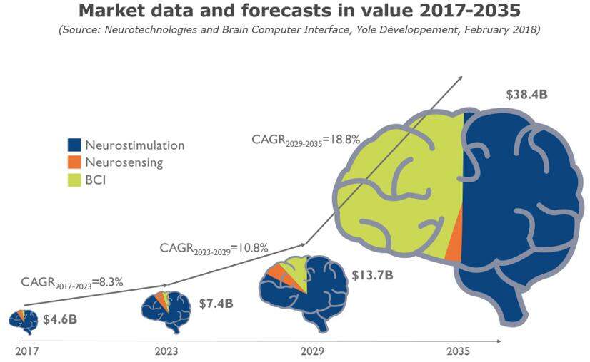 臻泰智能脑机,臻泰智能未来发展
